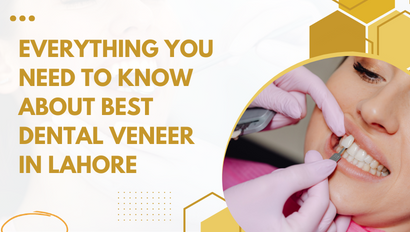 Everything You Need to Know About Best Dental Veneer In Lahore