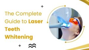 The Complete Guide to Laser Teeth Whitening