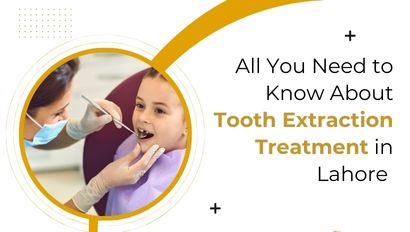 All You  Need to Know About Tooth Extraction Treatment in Lahore 