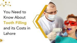 You Need to Know About Tooth Filling and its Costs in Lahore
