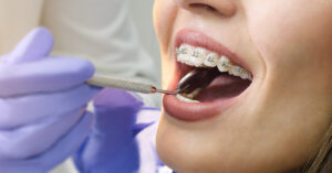 Orthodontics Dentists in Lahore