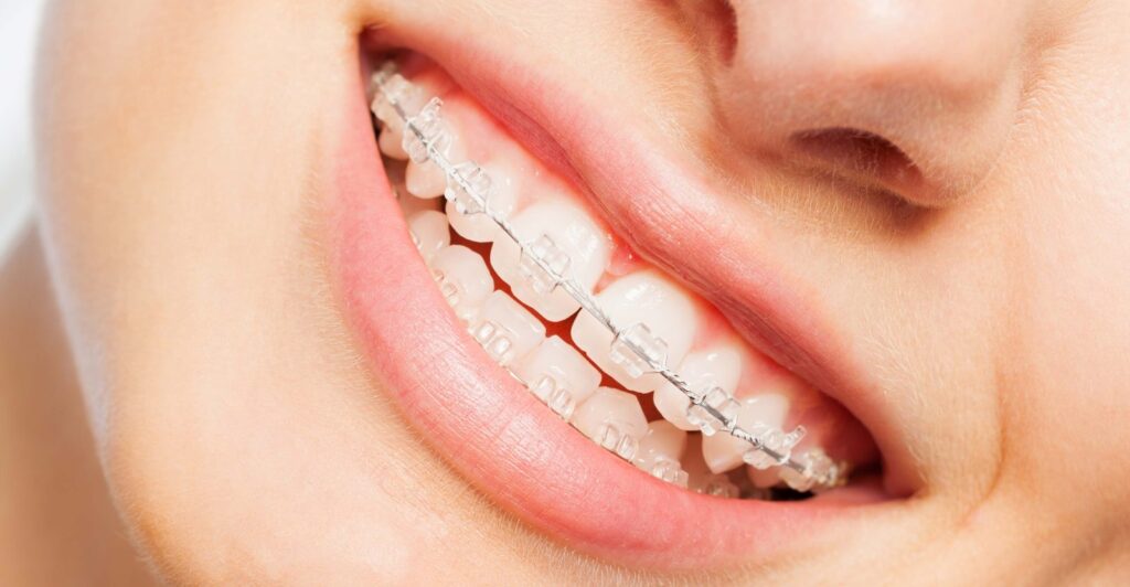Orthodontics Dentists in Lahore