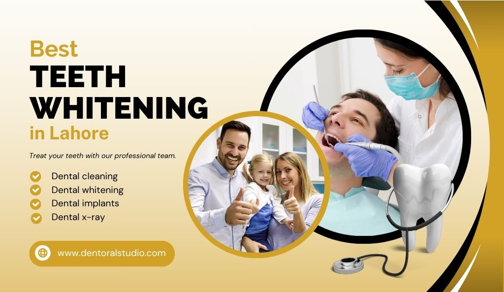 Best Teeth Whitening in Lahore