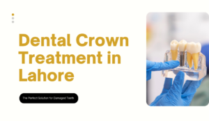 Dental Crown Treatment in Lahore