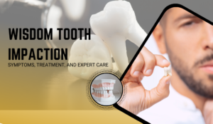 Wisdom Tooth Impaction