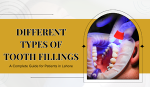 Different Types of Tooth Fillings