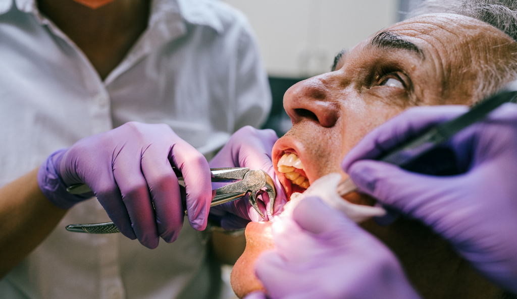 The Tooth Extraction Process