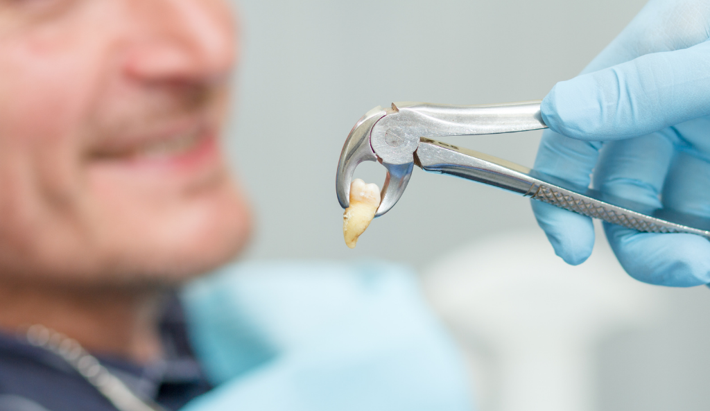 Why Choose Dentoral Studio for Tooth Extraction