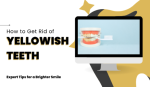 How to Get Rid of Yellowish Teeth
