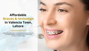 Affordable Braces & Invisalign