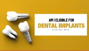 Dental Implants in Lahore