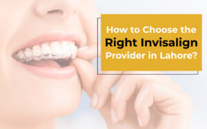 How to Choose the Right Invisalign Provider in Lahore_