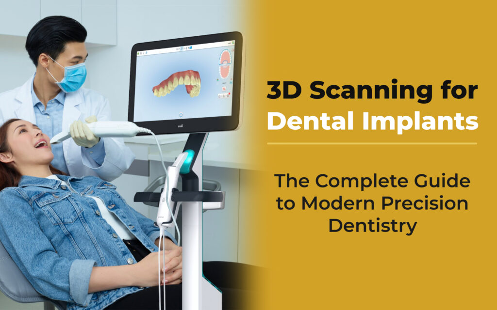 3D Scanning for Dental Implants - Guide to Advanced Precision Dentistry