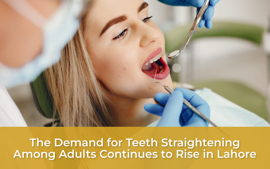 The Demand for Teeth Straightening Among Adults Continues to Rise in Lahore