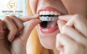 Best Invisalign Orthodontist in Lahore