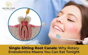 Why Rotary Endodontics Means You Can Eat Tonight
