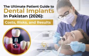 The Ultimate Patient Guide to Dental Implants in Pakistan (2026): Costs, Risks, and Results