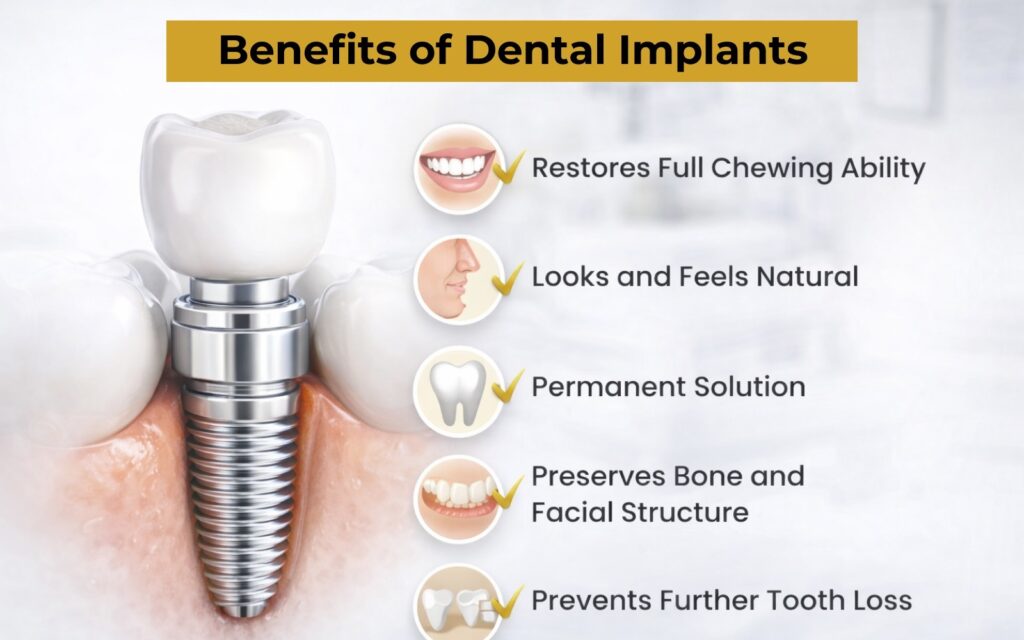 The Ultimate Patient Guide to Dental Implants in Pakistan (2026)