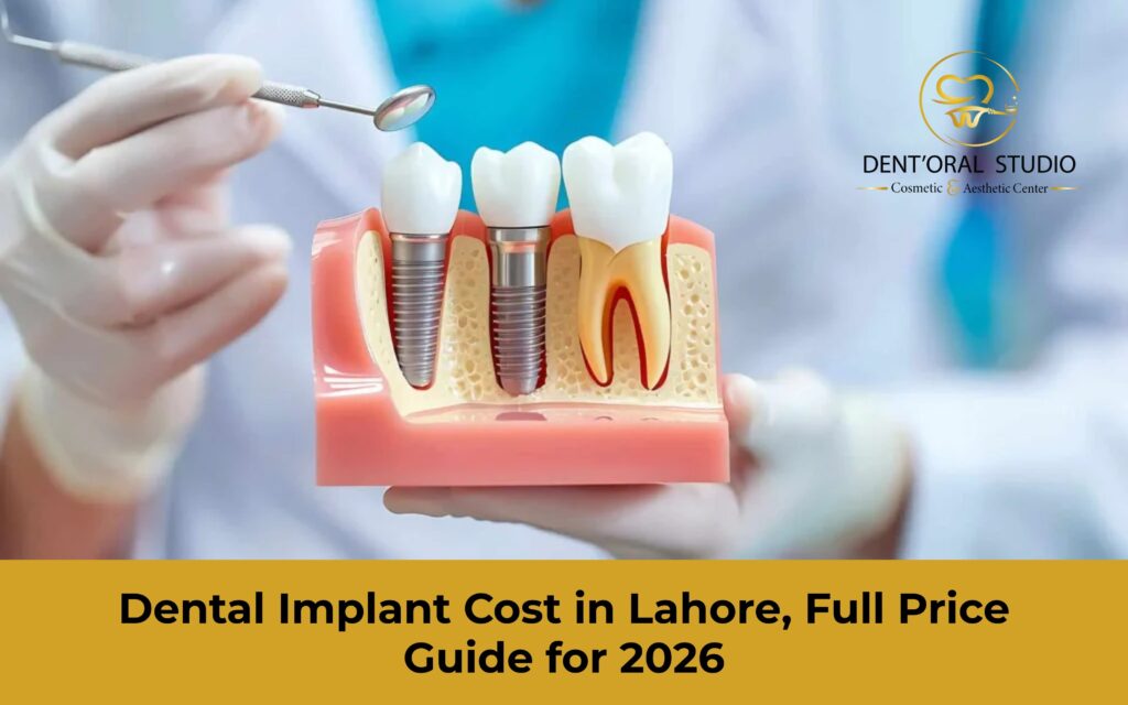 Dental Implants Cost in Lahore 2026 | A Complete Guide