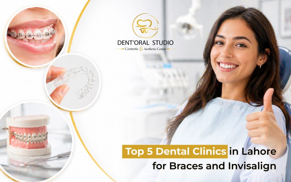 Top 5 Dental Clinics in Lahore for Braces and Invisalign